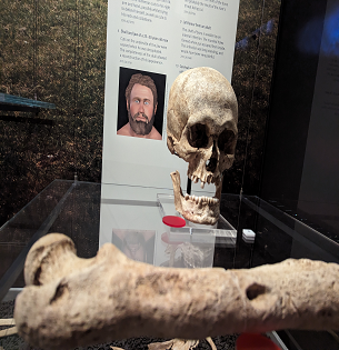 A human skull and jaw bone in front of a museum exhibition board and a long bone with trauma hole